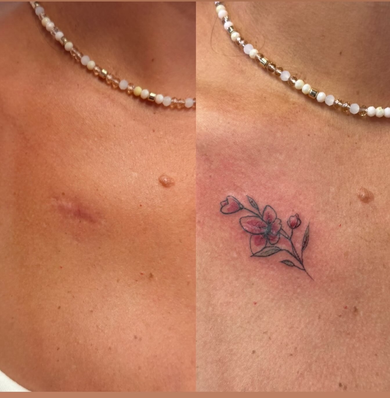 Cute little scar camouflage tattoo #finelineflowertattoo #scarcamoflauge #flowersofinstagram #njtattooartist #njtattooshop