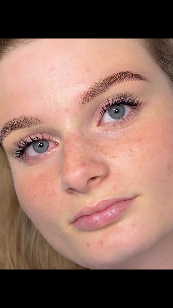 „Ich habe Angst, dass meine Augenbrauen danach abstehen.“
Das höre ich tatsächlich öfter.
Und ich verstehe es.
Wenn man Brow Lifting googelt, sieht man oft extrem nach oben gebürstete, sehr „fluffy“ Augenbrauen.
Aber genau so muss es nicht aussehen.
Beim Brow Lifting geht es für mich nicht darum, jedes Härchen möglichst weit nach oben zu bekommen.
Ich schaue auf deine natürliche Wuchsrichtung, deine Brauenform und darauf, was zu deinem Gesicht passt.
Das Ergebnis darf weich, gepflegt und natürlich aussehen. 🤎
Brow Lifting soll deine Augenbrauen nicht verändern – sondern sie besser zur Geltung bringen.
Würdest du ein Brow Lifting ausprobieren, wenn du wüsstest, dass es auch natürlich aussehen kann?
#browlift #browliftingmünchen #salzburg #brows