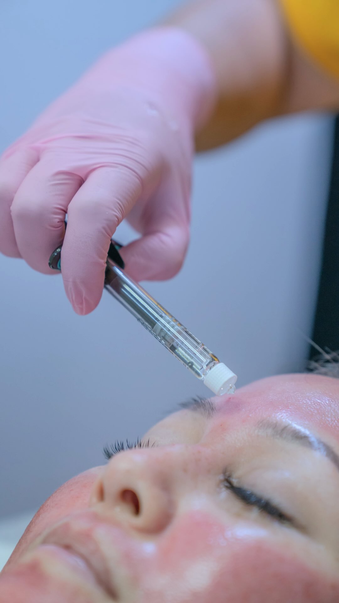 Korean aesthetics has helped popularize a different conversation around anti-aging: focusing not only on correcting individual lines or replacing volume, but on improving ✨skin quality itself✨
That’s where regenerative treatments and skin boosters come in.
🧬PDRN / Rejuran— used in regenerative skin protocols designed to support repair, hydration and overall skin quality.
And that’s what makes this approach so interesting.
Instead of asking:
“What can we add?”
We’re also asking:
“How can we help your skin function and rebuild better?”
Would you try a regenerative skin treatment? 👀
Comment “PDRN” if you want to learn more!
#hawaiiaesthetic #medspahonolulu #hawaiimedspa