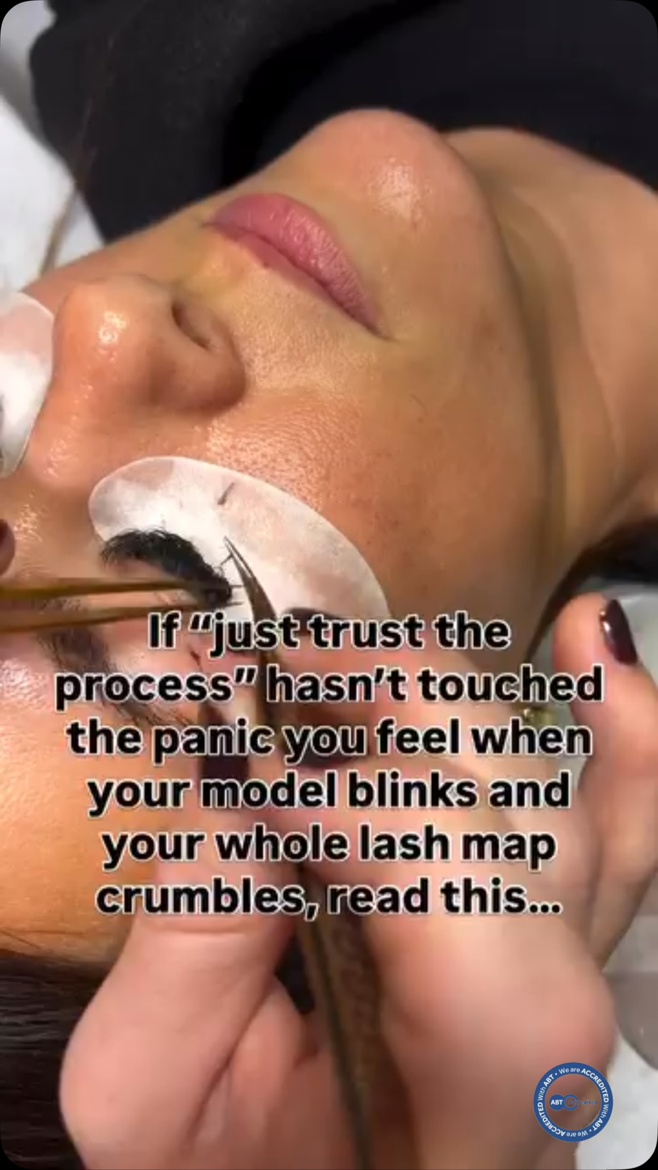 You’re not “bad at lashes.”
You’re learning a skill that takes patience, precision and practice. 🤍
At the beginning, it can feel like there’s SO much to think about…
Tweezers in one hand.
Isolation.
Placement.
Direction.
Adhesive.
Mapping.
Retention.
And a real client lying there while you’re trying to remember everything you’ve just learnt. 😅
It’s completely normal to finish your first few sets and think:
“How am I ever going to get good at this?”
But here’s what I tell my students…
✨ Your first set isn’t supposed to look like your 100th.
Confidence comes from understanding what you’re doing, practising it properly and having someone there to guide you when things aren’t quite going to plan.
That’s exactly how I teach my lash courses.
With over 22 years in the beauty industry, I don’t just show you how to apply lashes and send you on your way.
I teach you the WHY behind what you’re doing from isolation and placement to adhesive, styling, retention and troubleshooting with hands-on practice, real models and continued support after your training day. 🤍
Because becoming a great lash tech isn’t about being perfect on day one.
It’s about having the right training, the right foundations and the right support while you build your confidence.
If becoming a lash tech has been sitting in the back of your mind, maybe this is your sign. ✨
DM me “LASHES” and I’ll send you details of my upcoming lash training.