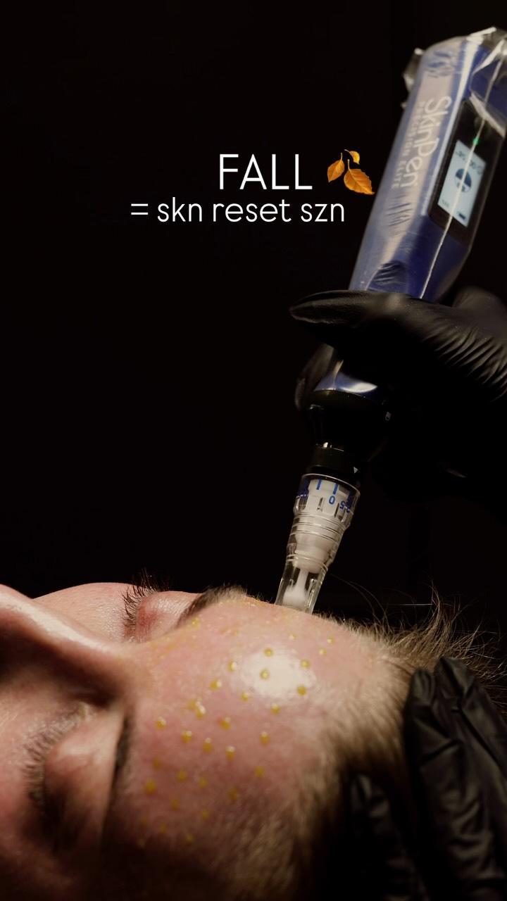 New season, fresh skin.
Fall is the perfect time to start a skin reset: getting rid of sun damage, dull skin, wrinkles, treating rosacea, melasma or acne.
With our social schedules slowing down, kids in school, lower temperatures, it’s much easier to find time to get those “downtime” treatments we’ve been putting off for so long.
Remember to always start with a Diamond Glow Facial (add Dermaplaning for a better exfoliated surface), so we can have a clean canvas to work on (and not through layers and layers of cemented dead skin).
Consultations are highly recommended, where we sit down to create a skincare plan after taking Visia pictures of your skin to analize together based on your concerns.