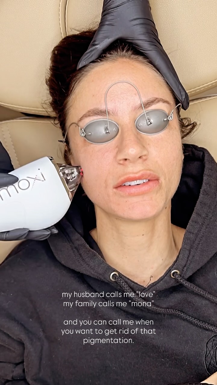 ⚡️MOXI - sun damage, superficial melasma, smoother texture.