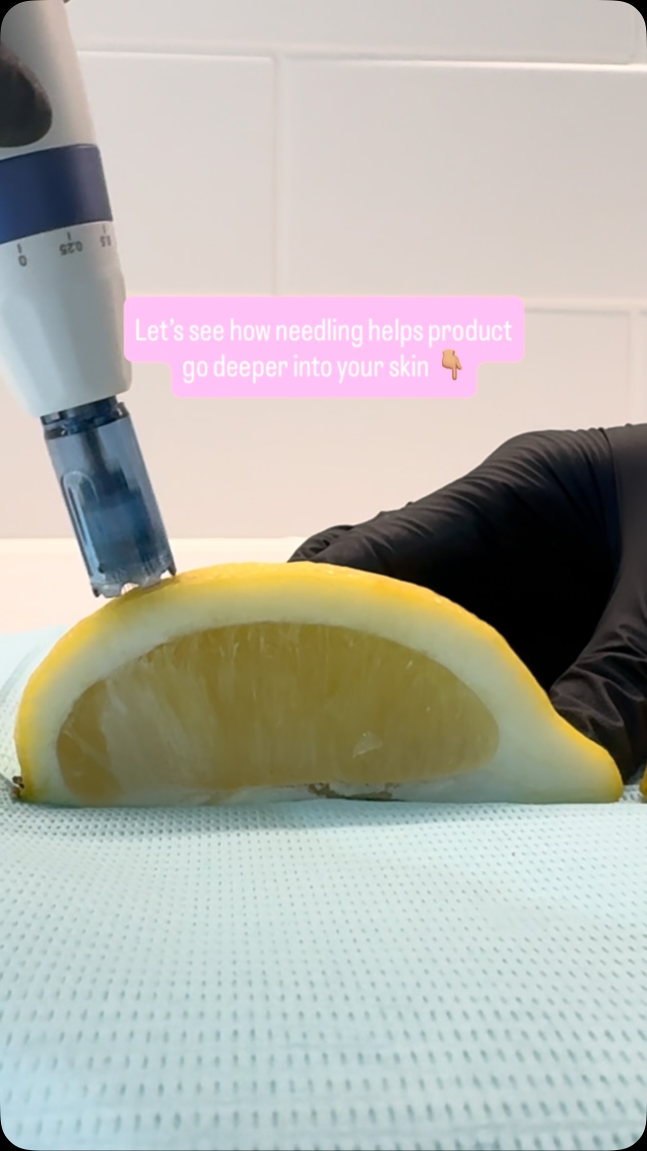 Lemons don’t lie. 🍋
watch where the serum goes! Book in your next microneedling appointment with us this month ✨